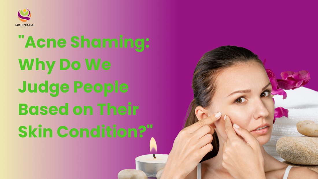 ACNE SHAMING: WHY DO WE JUDGE PEOPLE BASED ON THEIR SKIN CONDITION?